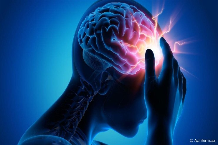 “Epilepsiya xəstəliyinin bəzi simptomlarını bilmək vacibdir” - Həkim-nevroloq